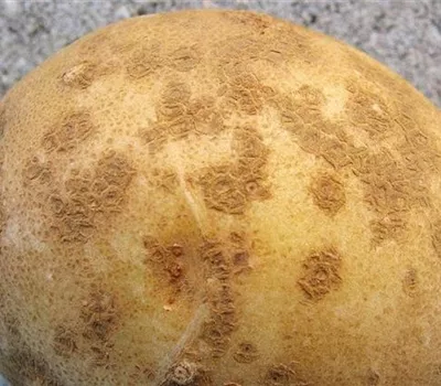 Schorf an Kartoffeln